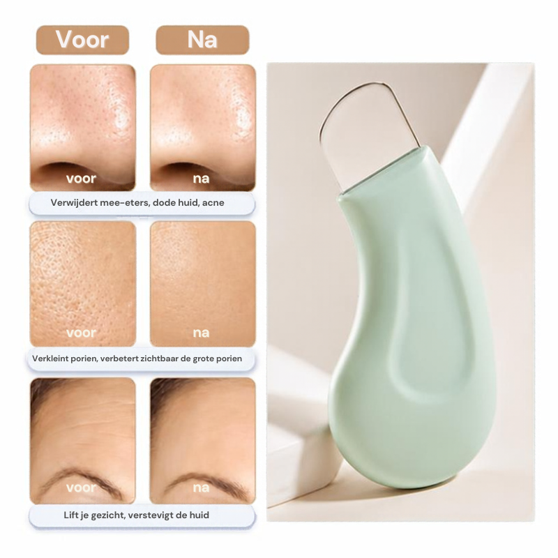 Gezichtstool voor mee-eters